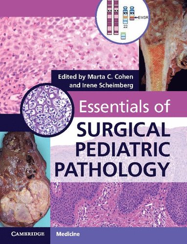 bokomslag Essentials of Surgical Pediatric Pathology with DVD-ROM