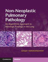 bokomslag Non-Neoplastic Pulmonary Pathology with Online Resource