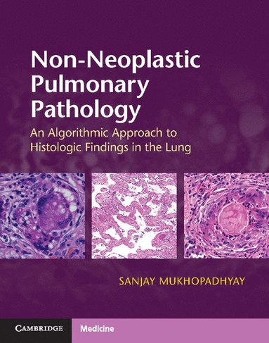 bokomslag Non-Neoplastic Pulmonary Pathology with Online Resource