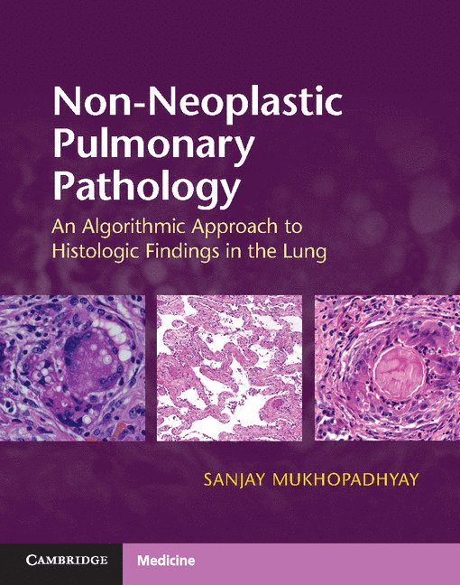 Non-Neoplastic Pulmonary Pathology with Online Resource 1