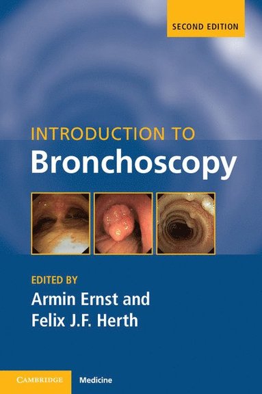 bokomslag Introduction to Bronchoscopy