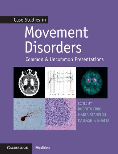 Kailash P. Bhatia, Roberto Erro, Maria Stamelou - Case Studies in Movement Disorders, Häftad