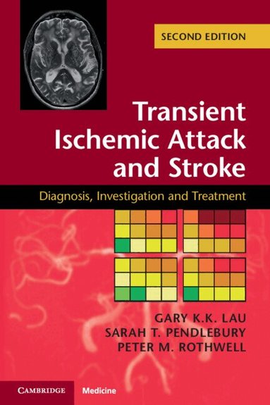 Gary K. K. Lau, Sarah T. Pendlebury, Peter M. Rothwell - Transient Ischemic Attack and Stroke, Häftad