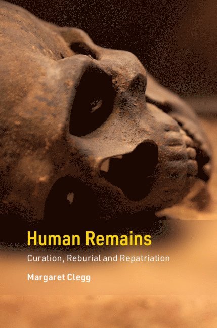 Human Remains 1