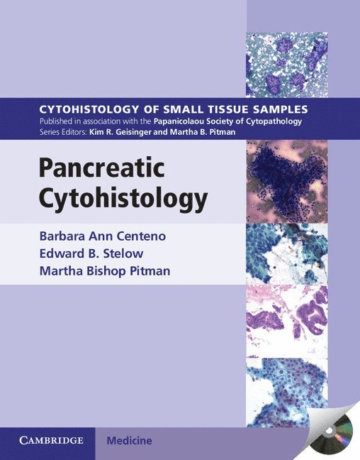 Pancreatic Cytohistology 1