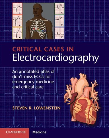 bokomslag Critical Cases in Electrocardiography