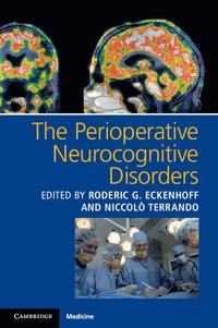 bokomslag Perioperative Neurocognitive Disorders