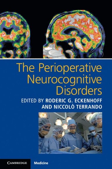 bokomslag Perioperative Neurocognitive Disorders