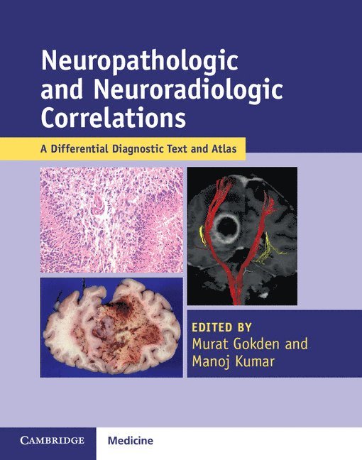 Neuropathologic and Neuroradiologic Correlations 1