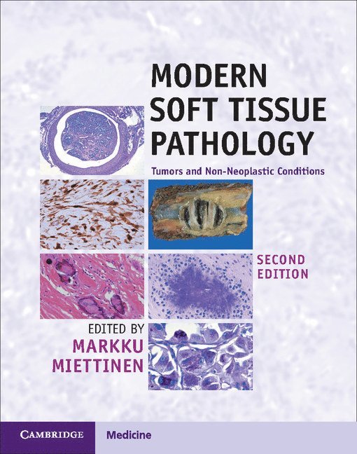 Modern Soft Tissue Pathology 1