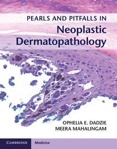 bokomslag Pearls and Pitfalls in Neoplastic Dermatopathology with Online Access