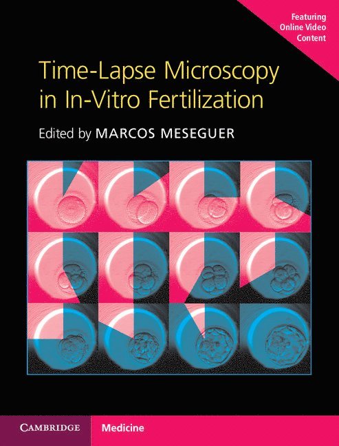 Time-Lapse Microscopy in In-Vitro Fertilization Hardback with Online Resource 1