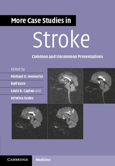 Michael G. Hennerici, Rolf Kern, Louis R. Caplan, Kristina Szabo - More Case Studies in Stroke, Häftad