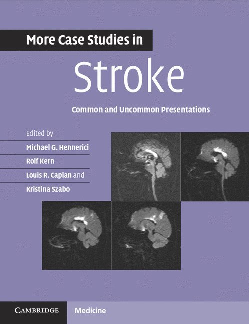 More Case Studies in Stroke 1