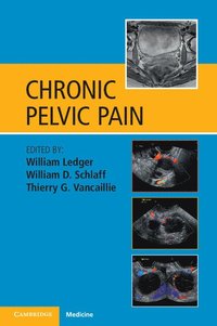bokomslag Chronic Pelvic Pain