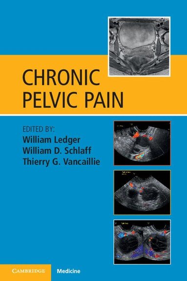 William Ledger, William D. Schlaff, Thierry G. Vancaillie - Chronic Pelvic Pain, Häftad