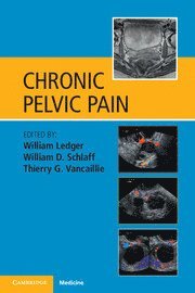 William Ledger, William D. Schlaff, Thierry G. Vancaillie, Sydney) Ledger, William (University of New South Wales, Sydney) Vancaillie, Thierry G. (University of New South Wales, William D Schlaff, Thierry G Vancaillie - Chronic Pelvic Pain, Häftad
