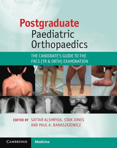 bokomslag Postgraduate Paediatric Orthopaedics