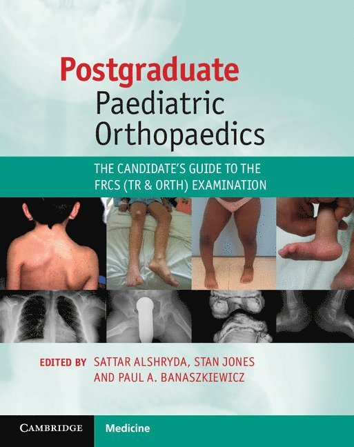 Postgraduate Paediatric Orthopaedics 1