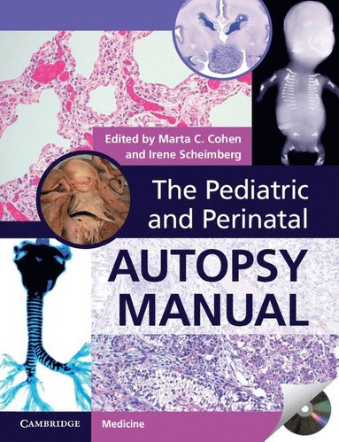 bokomslag The Pediatric and Perinatal Autopsy Manual with DVD-ROM