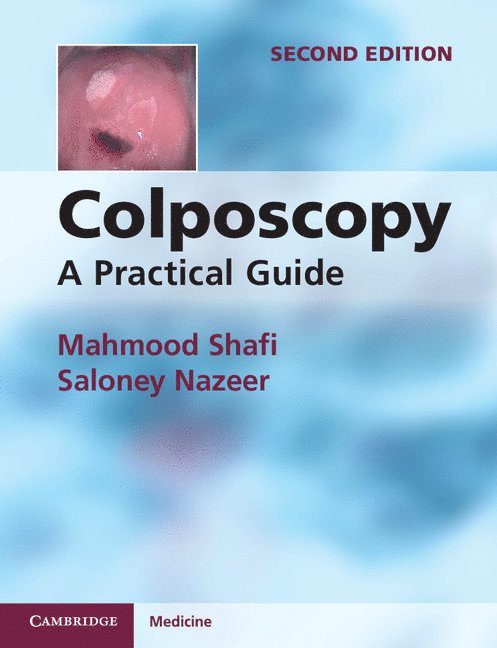 Mahmood Shafi, Saloney Nazeer - Colposcopy, Häftad
