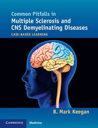 bokomslag Common Pitfalls in Multiple Sclerosis and CNS Demyelinating Diseases