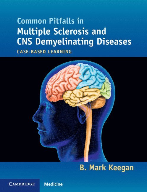 B. Mark Keegan, B Mark Keegan - Common Pitfalls in Multiple Sclerosis and CNS Demyelinating Diseases, Häftad