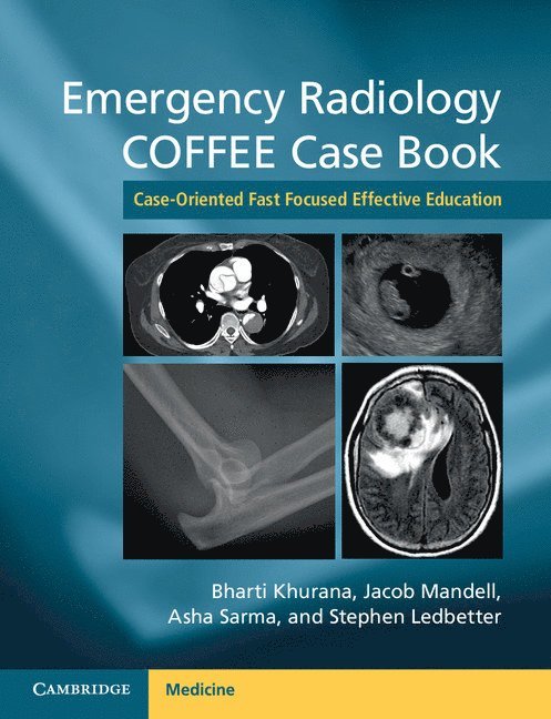 Bharti Khurana, Jacob Mandell, Asha Sarma, Stephen Ledbetter - Emergency Radiology COFFEE Case Book, Häftad