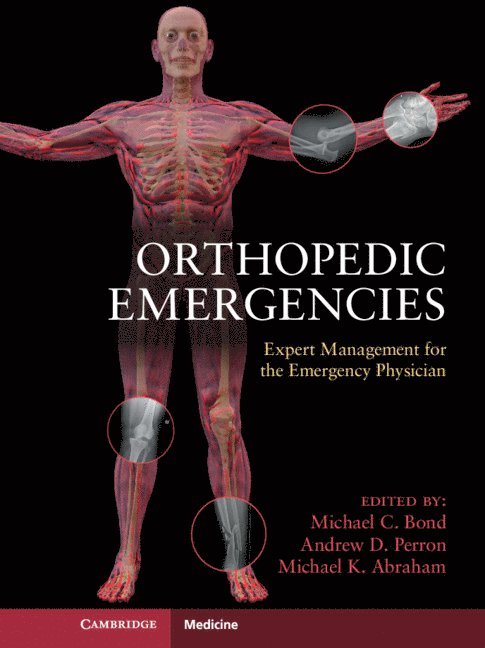 Michael C. Bond, Michael C Bond - Orthopedic Emergencies, Häftad