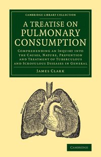 bokomslag A Treatise on Pulmonary Consumption
