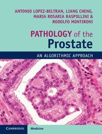 bokomslag Pathology of the Prostate
