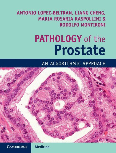 Pathology of the Prostate 1
