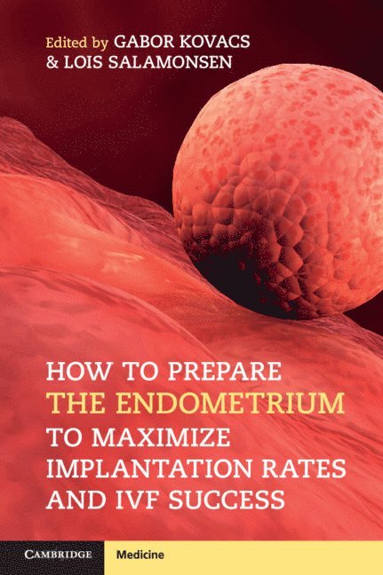 How to Prepare the Endometrium to Maximize Implantation Rates and IVF Success 1