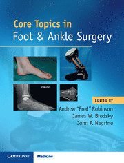bokomslag Core Topics in Foot and Ankle Surgery