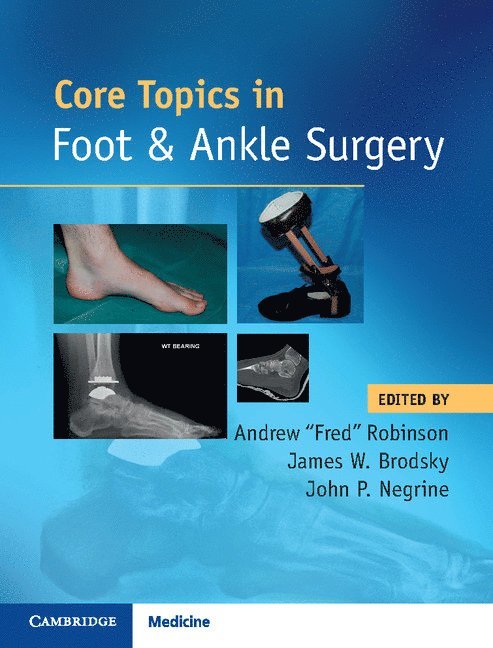 Andrew Robinson, James W. Brodsky, John P. Negrine, James W Brodsky, John P Negrine - Core Topics in Foot and Ankle Surgery, Inbunden