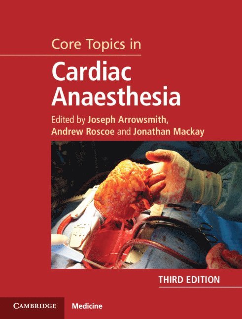 Joseph Arrowsmith, Andrew Roscoe, Jonathan Mackay - Core Topics in Cardiac Anaesthesia, Inbunden