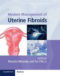bokomslag Modern Management of Uterine Fibroids