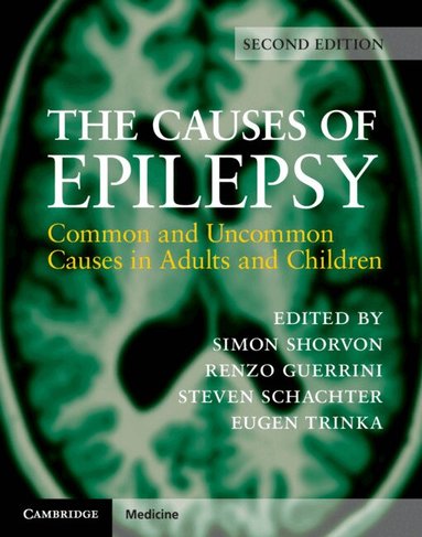 Simon Shorvon, Renzo Guerrini, Steven Schachter, Eugen Trinka - The Causes of Epilepsy, Inbunden