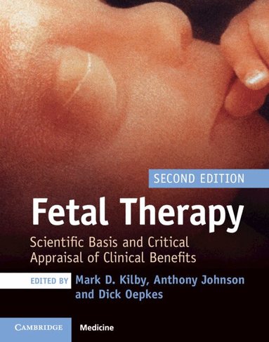 Mark D. Kilby, Anthony Johnson, Dick Oepkes - Fetal Therapy, Inbunden