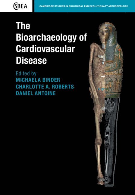 Michaela Binder, Charlotte A. Roberts, Daniel Antoine, Michaela (Novetus GmbH Archaeological Services) Binder, Charlotte A. (Durham University) Roberts, London) Antoine, Daniel (British Museum, Charlotte A Roberts - The Bioarchaeology of Cardiovascular Disease, Inbunden