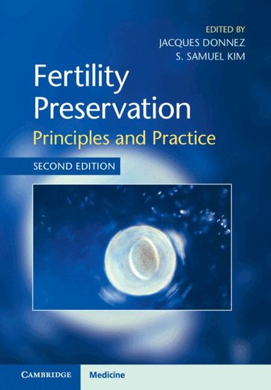 Jacques Donnez, S. Samuel Kim - Fertility Preservation, Inbunden