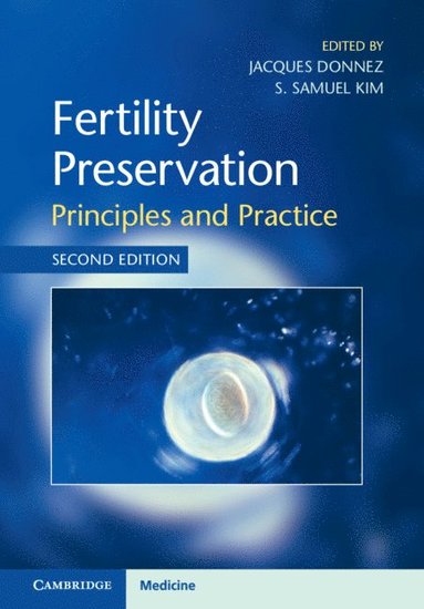 bokomslag Fertility Preservation