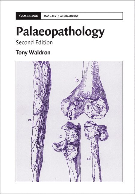 Palaeopathology 1