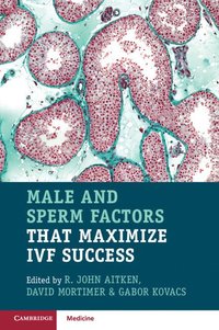 bokomslag Male and Sperm Factors that Maximize IVF Success