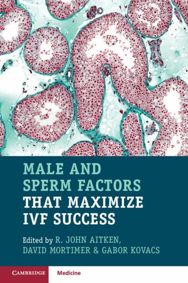 R. John Aitken, David Mortimer, Gabor Kovacs - Male and Sperm Factors that Maximize IVF Success, Häftad