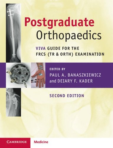 bokomslag Postgraduate Orthopaedics