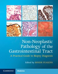 bokomslag Non-Neoplastic Pathology of the Gastrointestinal Tract with Online Resource