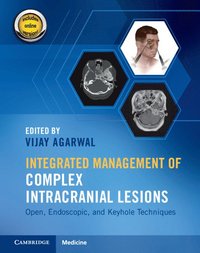 bokomslag Integrated Management of Complex Intracranial Lesions Hardback Set and Static Online Product