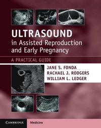 bokomslag Ultrasound in Assisted Reproduction and Early Pregnancy