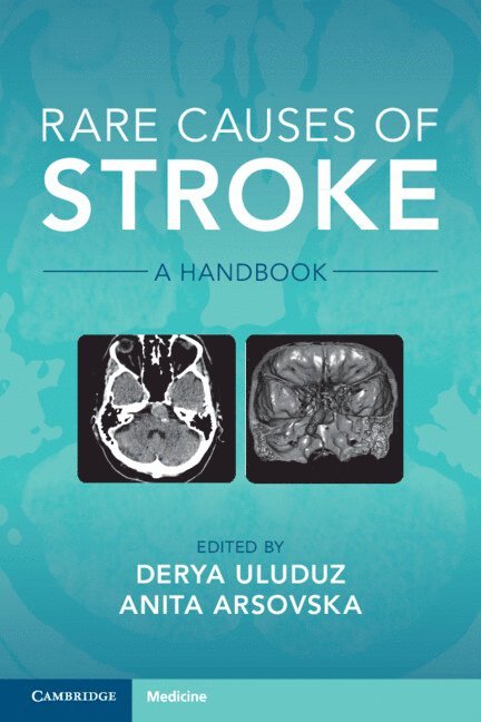 Anita Arsovska, Derya Uluduz, Derya (Istanbul Universitesi) Uluduz - Rare Causes of Stroke, Häftad
